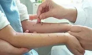 宝宝过敏怎么办？教你几个妙招，让宝宝不再遭罪！