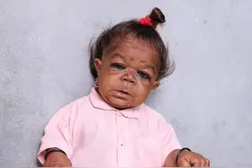 印度侏儒身高53厘米，家人耗巨资医治无效，却受全村人的膜拜视频封面