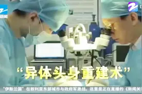 中国教授完成全球首例人类“换头术”，耗时18小时视频封面