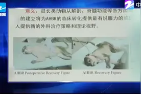 哈医教授任晓平谈“换头术”质疑视频封面