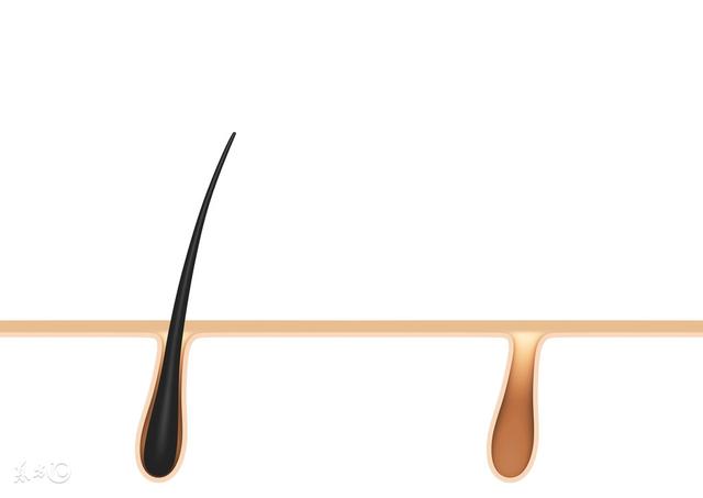 毛囊角化会按顺序出吗