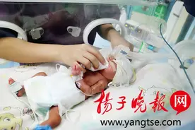 宿迁“巴掌女婴”出院，准妈妈生产时刚怀孕五个多月图片