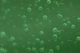 外泌体应用于肝细胞癌诊疗的研究进展图片