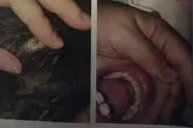 吉林四平红黄蓝虐童案：首个报案妈妈回忆两年前情形仍难忍泪水！视频封面