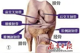 涨姿势 跑步者常见的膝关节疼痛局部原因分析图片