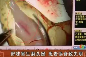 震惊！患者误食野味寄生虫裂头蚴导致失明视频封面