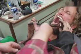 外国人自己用钳子拔牙，看着都疼