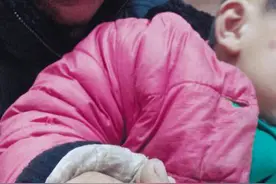 手指意外划伤8月大婴儿险截肢，原因竟是家长的处理方法不对图片