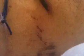 女子被货车撞，而她就是几天前一位母亲寻找的智障女儿！图片