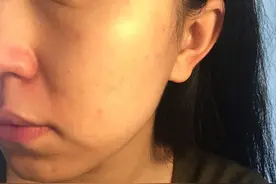 一个黄皮+封闭脸的SAINT LAURENT PARIS 伊夫圣罗兰 逆龄粉底液使用简评图片