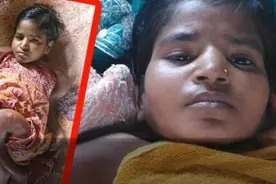 印度少女染怪病致身体不断萎缩 25岁身高仅60厘米图片