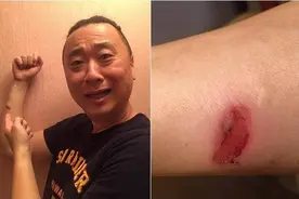 邰智源吃火锅被烫伤 郭子乾莫名躺枪图片