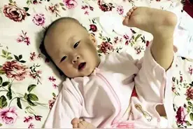 婴儿湿疹 4大元凶导致宝宝湿疹图片