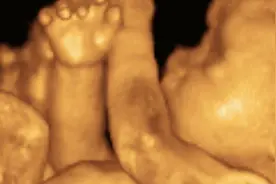 孕期去做四维彩超，看到的胎儿性别和长相，这到底准不准？