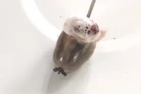 30%高浓度双氧水注射蜱虫，看到蜱虫的下场，真是太完美了视频封面