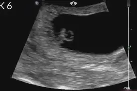 腹中胎儿的成长过程，原来是这样孕育的