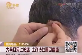 大爷耳朵上长痣 土办法处置引癌变视频封面
