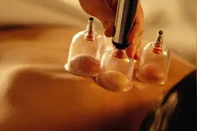 中医理疗有禁忌须谨慎图片