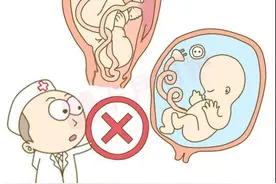 孕37周～分娩第49课:超过预产期怎么办？图片