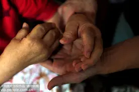 类风湿性关节炎患者如何饮食？这些食物可缓解症状图片