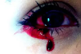 英国少女患怪病:眼耳鼻舌每日流血图片