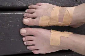 跑者防止脚起水泡:穿合适的鞋袜 脚底抹润滑剂图片