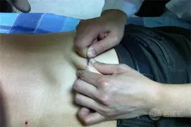 痔疮患者有肝硬化不能进行手术治疗图片