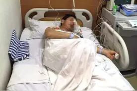 工人遭1米长钢筋插穿头 经4小时手术死里逃生图片