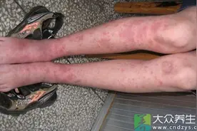 六十岁女人得一病三年不洗脚图片