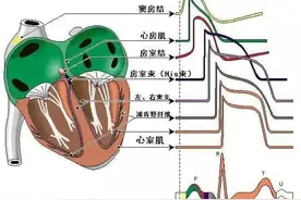 心脏电生理检查，心律失常界的“福尔摩斯”图片