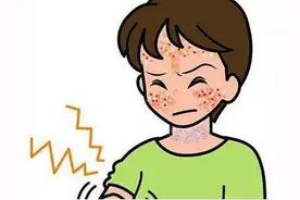 聊聊关于儿童咳嗽的那些事儿！图片