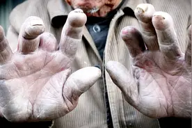 9旬老人做木匠84年，为赚钱攒医药费被电锯削掉两根手指视频封面