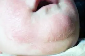 宝宝脸皴了？冬天做好这几点，让宝宝皮肤又白又娇嫩！视频封面