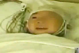 警惕！7岁小孩常在梦里大笑，医院一查竟是癫痫，家长吓坏了