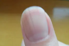 科普小知识，手指指甲上的月牙到底是越多越好还是越少越好？视频封面