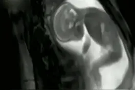 妈妈感受到肚皮上的胎动是这样的，其实宝宝在妈妈肚子里是这样的