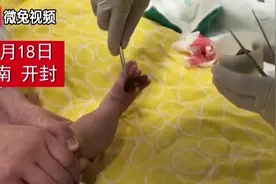心疼！两月大的宝宝，脚趾被头发丝缠住险被截趾视频封面