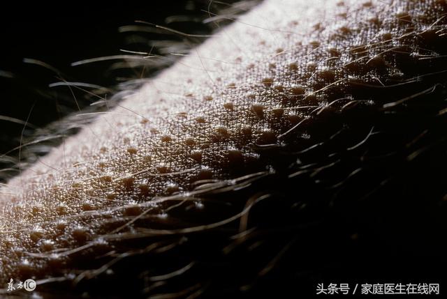 为什么特别热的时候起鸡皮疙瘩