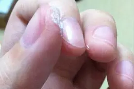 502胶水把手黏住了怎么办 几个小妙招要牢记图片