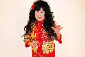 “西门大妈”领衔整容失败的明星 谁最惨图片