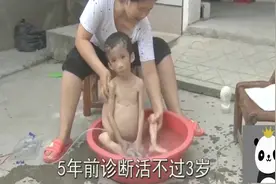 世界上居然还有长尾巴的人？到底是什么因素让他们改变了呢？