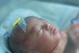 宝宝出现紫绀现象妈妈们需警惕图片