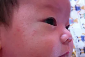 不同季节出身的宝宝我们应该怎么预防疾病。图片