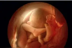 注意！孕期吃这些鱼，会伤到胎儿，你绝对不知道秘密图片