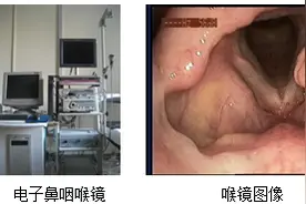 声音变哑不可小觑！各种原因、检查、治疗请留存图片