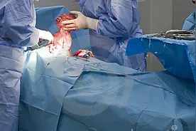 看完这剖腹产全过程，你会觉得剖腹产妈妈们很辛苦的确很伟大！图片