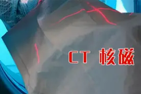 血清检查能查出胰腺癌吗？听听专业医生的讲解就一目了然了