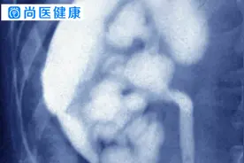 慢性肾炎是怎么引起的？肾病专家：致病因素都隐藏在这里！小心啊视频封面