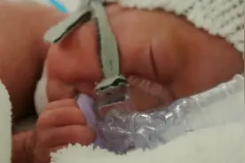 出生时不足一斤的早产儿宝宝求生欲很强，希望他能创造生命奇迹！