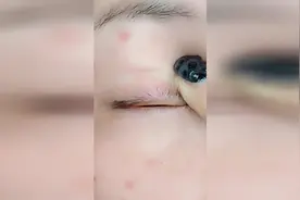 双眼皮贴老是贴不好 怎么办呢视频封面